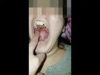 Girl Bites Fingers very Hard