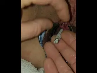 Peehole Cigarette Torture. BDSM Speculum Stretched Female Urethral Sounding
