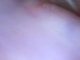Endoscope Cervix Exploration (Camera inside Vagina)
