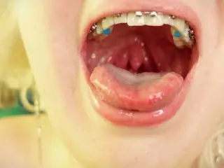 Braces Mouth Tour Video - CloseUp Vore Fetish - Tongue Saliva