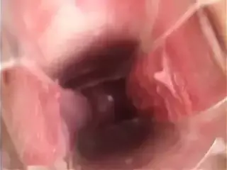 Preciosa anglosajona speculum cervix insertioon object