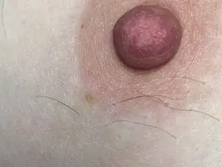 Hairy tits