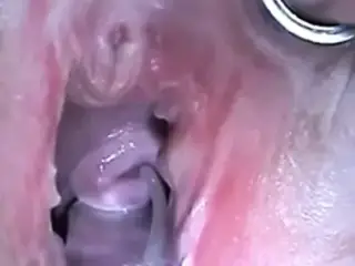 Cum Injection with Syringe in Cervix Uterus after Fucking