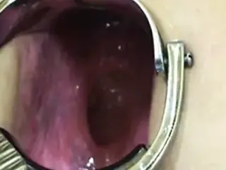 Elmer wife extreme anal speculum play