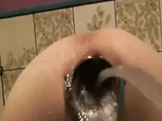 Tight asshole stretched by speculum for a water enema