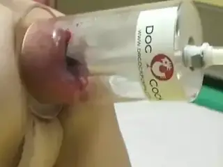 XXL anal vacuum pumping and fisting