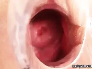 Brunette nurse babe gaping pussy and masturbation