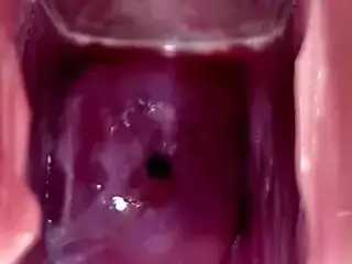 Cervix Throbbing and Flowing Oozing Cum During Close Up Speculum Play