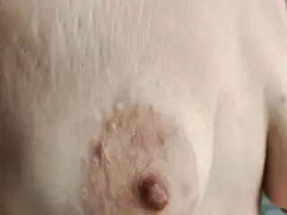 Close-up saggy tits with stretch marks