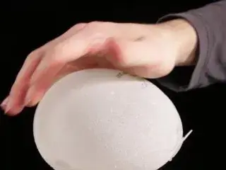 Filling breast implants