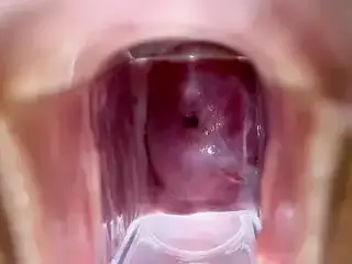 Stella St. Rose - Extreme Cervix Views and Juices Flowing Using a Speculum