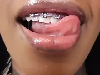 Black girl teeth brace fetish!